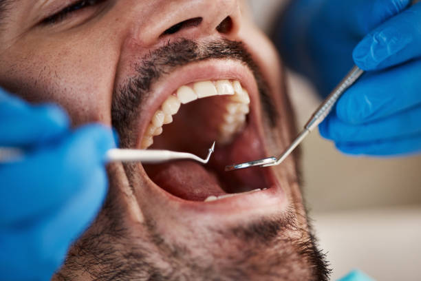 Best Emergency Broken Tooth Repair in Smithfield, NC